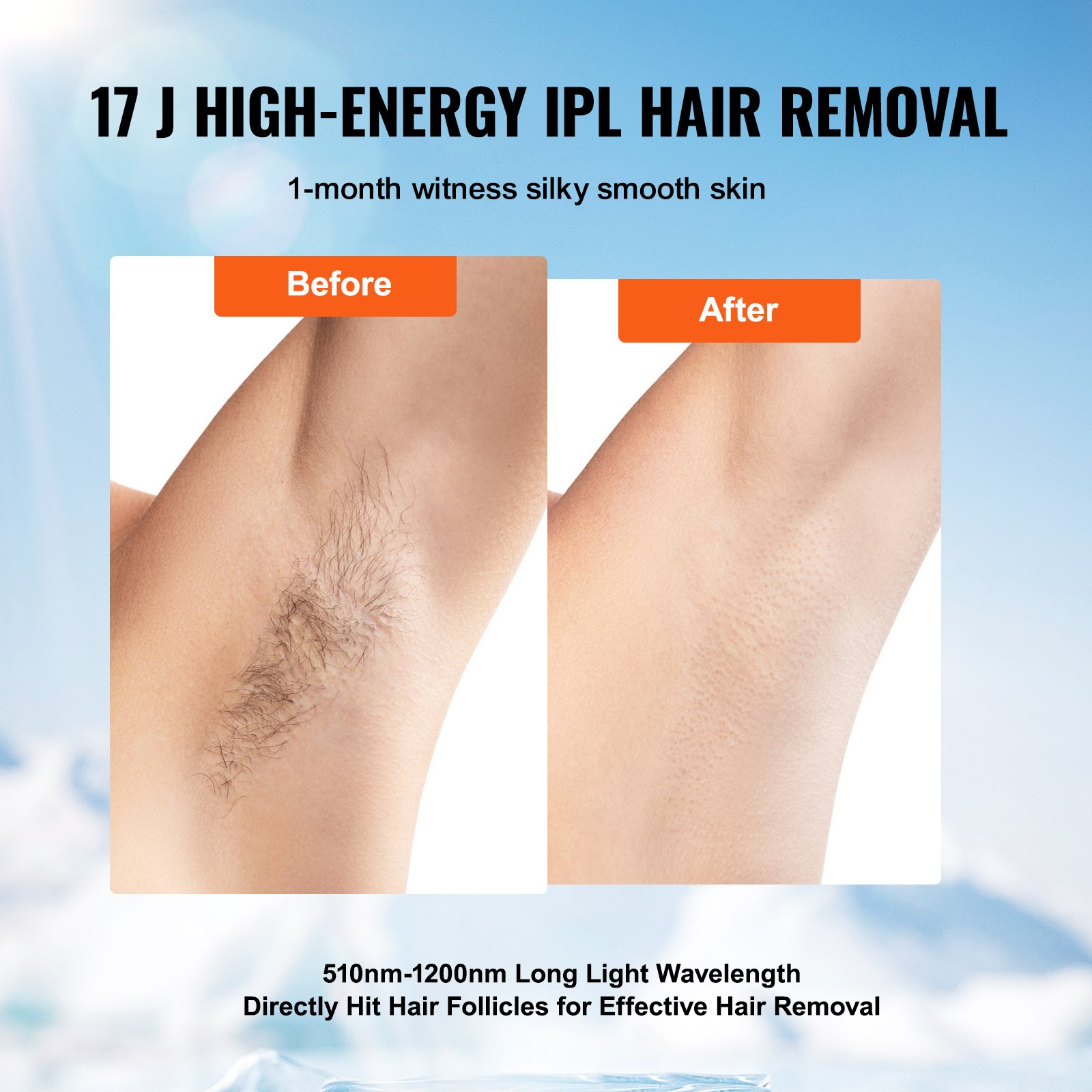 Start2Finish VEVOR IPL hair removal device with sapphire cooling, showing a sleek handheld beauty tool for painless at-home hair removal.