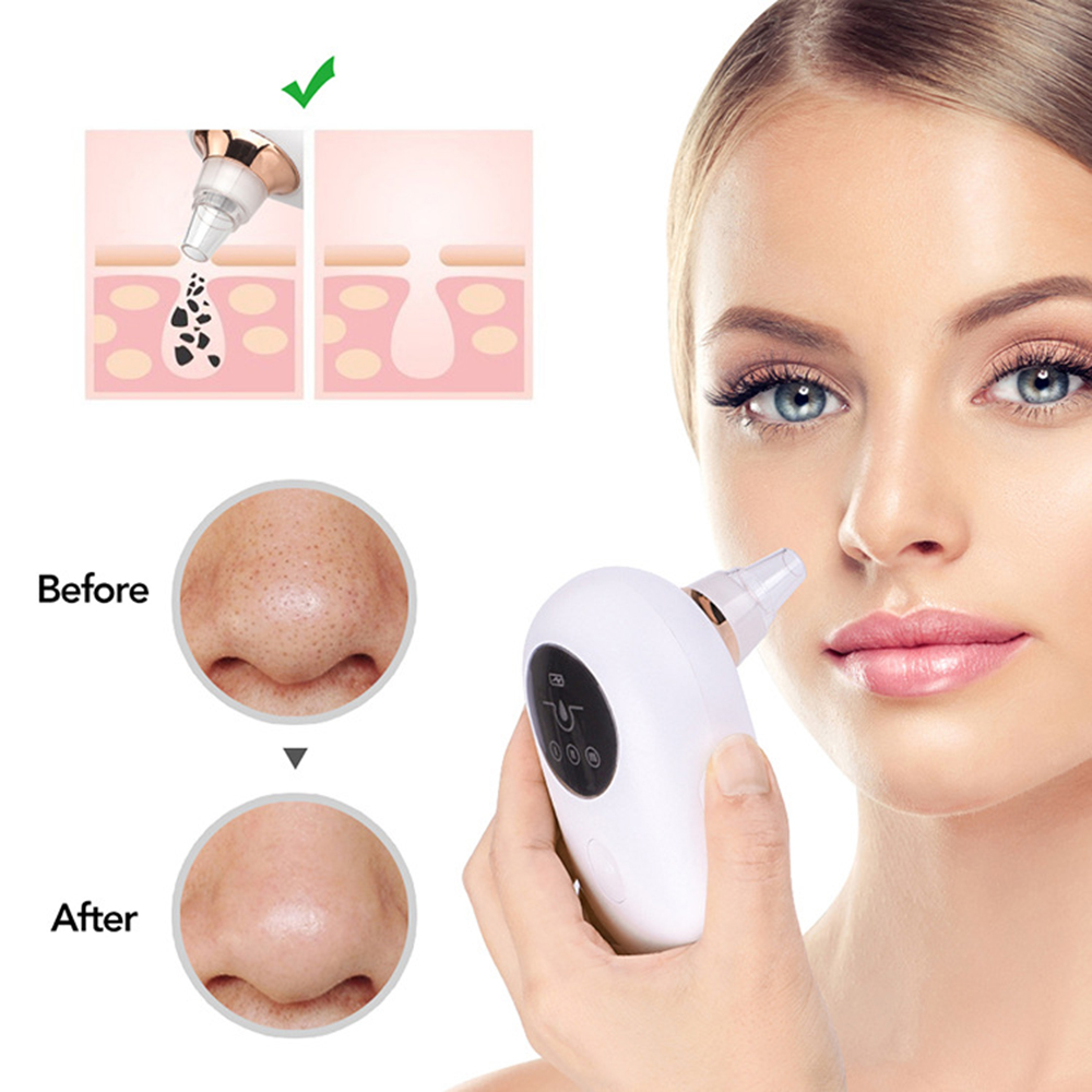 Blackhead remover vacuum device from Teal Simba designed for deep pore cleansing and skincare.